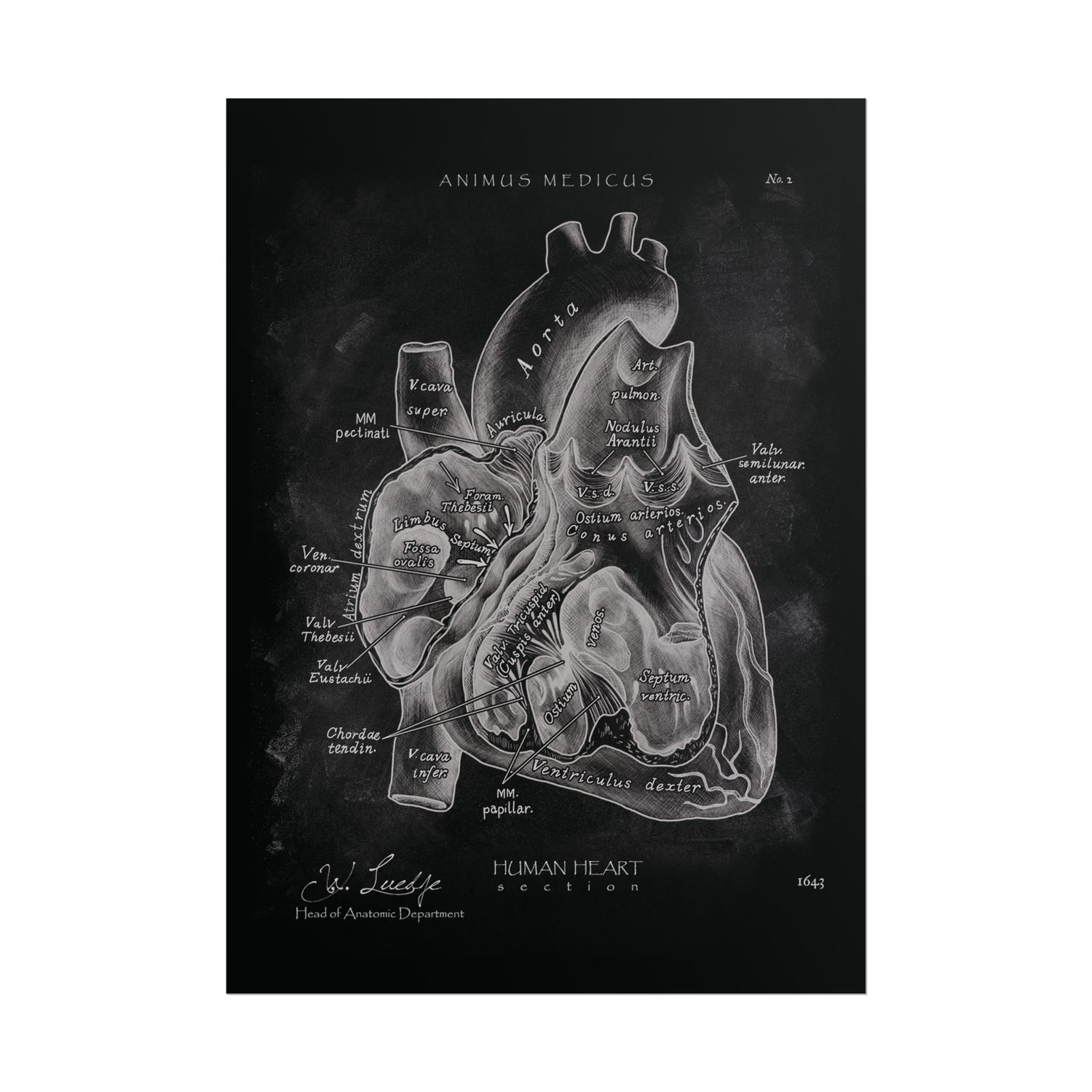Heart Section - Chalkboard