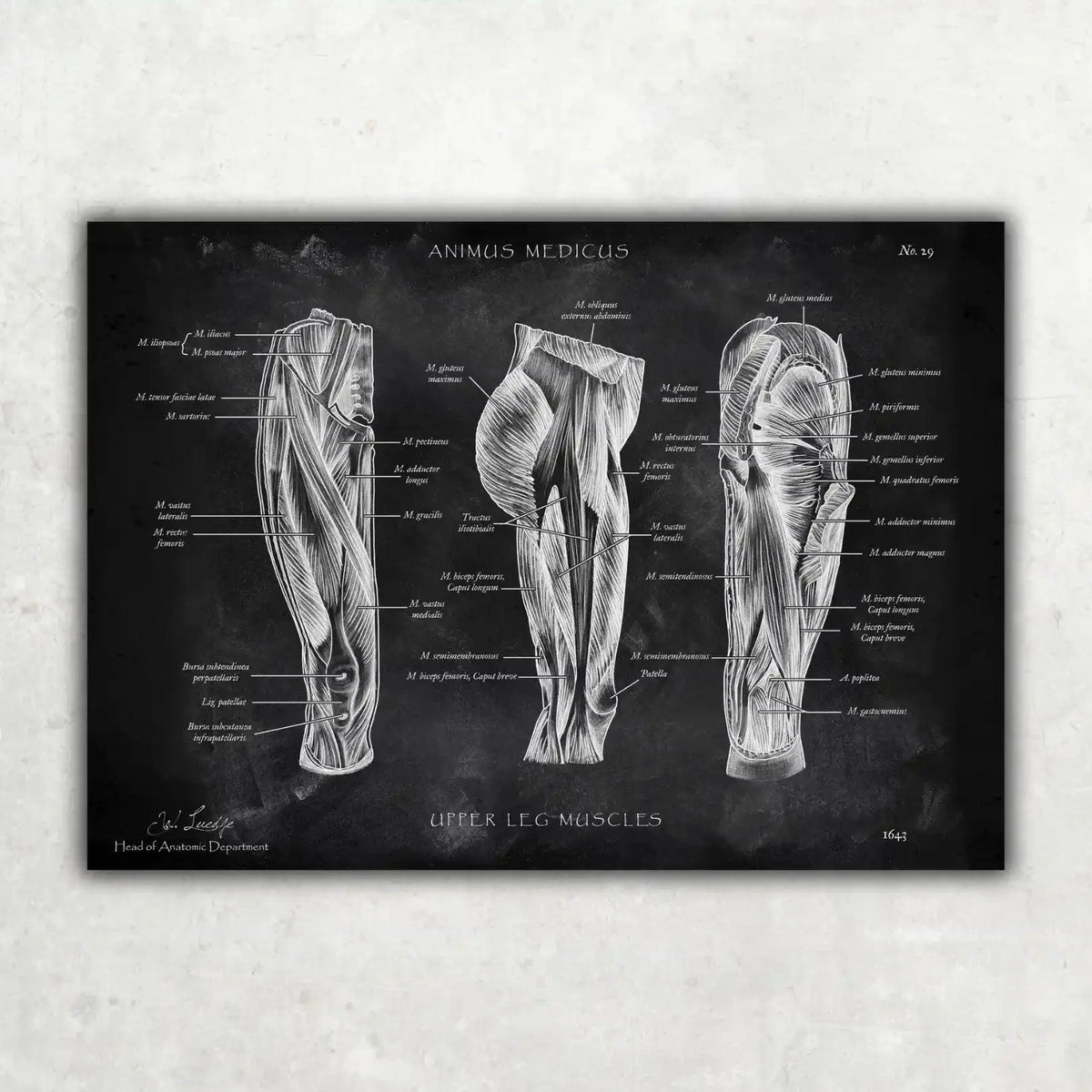 Oberschenkel Muskeln - Chalkboard - Animus Medicus GmbH