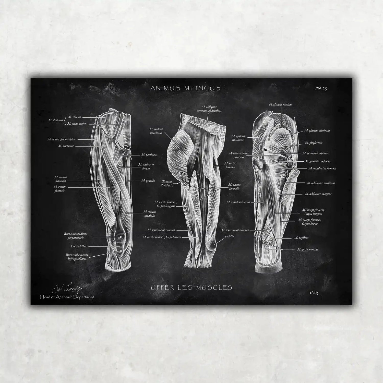 Oberschenkel Muskeln - Chalkboard - Animus Medicus GmbH