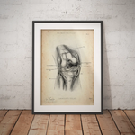 Unhappy Triad Knee