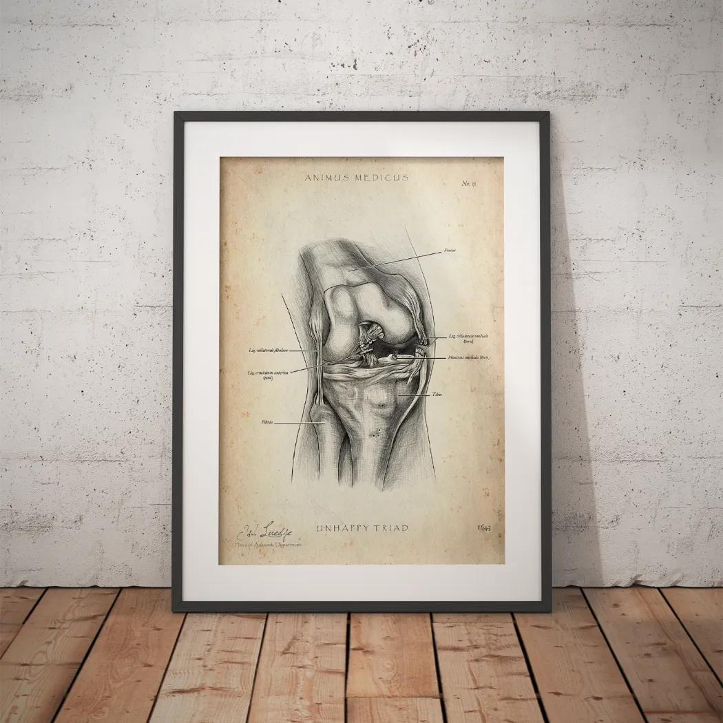 Unhappy Triad Knee