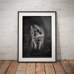 Unhappy Triad Knee - Chalkboard