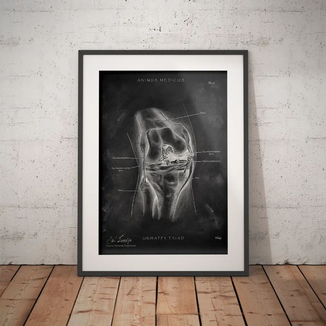 Unhappy Triad Knee - Chalkboard