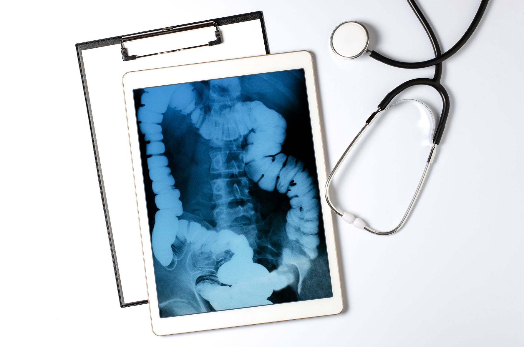 X-rays Explained: A Fascinating Look Inside