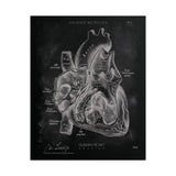 Heart Section - Chalkboard