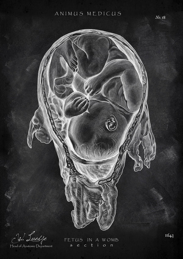 Baby in the Womb - Chalkboard