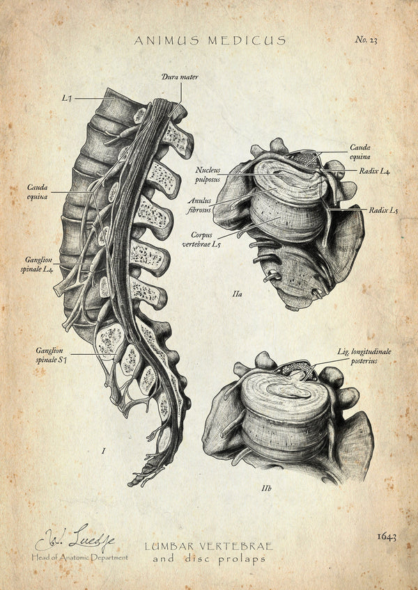 Herniated Disc Anatomy