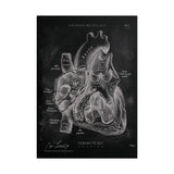 Heart Section - Chalkboard