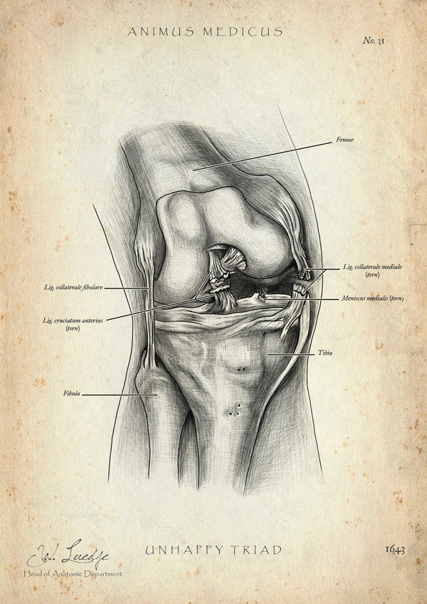 Unhappy Triad Knee