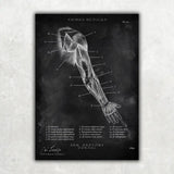 Dorsal Arm Anatomy - Chalkboard