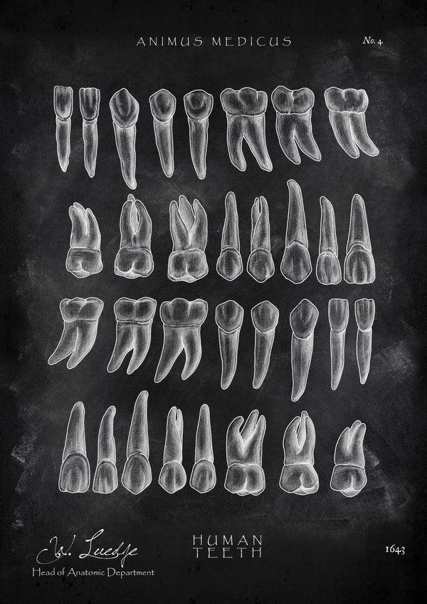 Overview of teeth - Chalkboard
