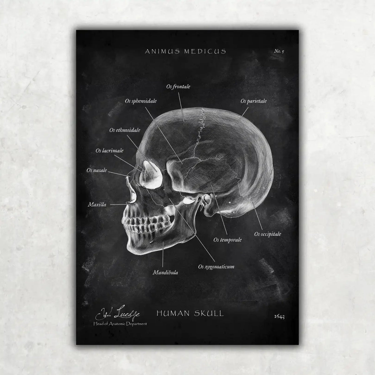 5er Paket Chalk Edition - Bestseller - Animus Medicus GmbH