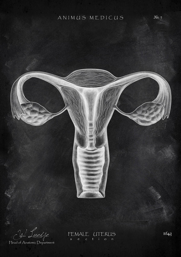 Uterus Anatomy - Chalkboard