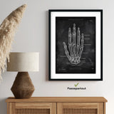 Hand Bones Anatomy - Chalkboard