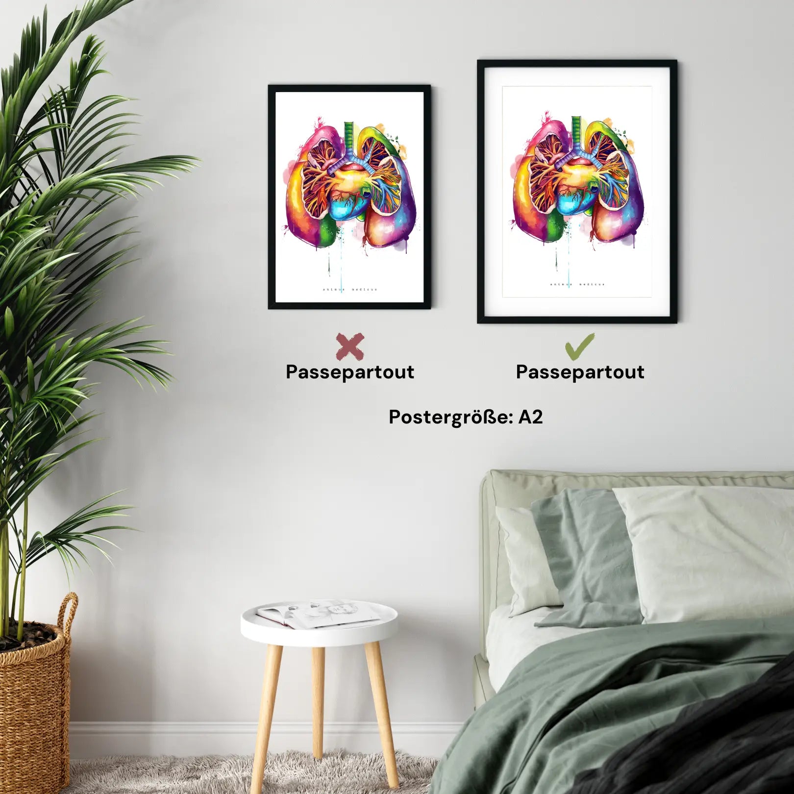 Lungs Anatomy - Rainbow