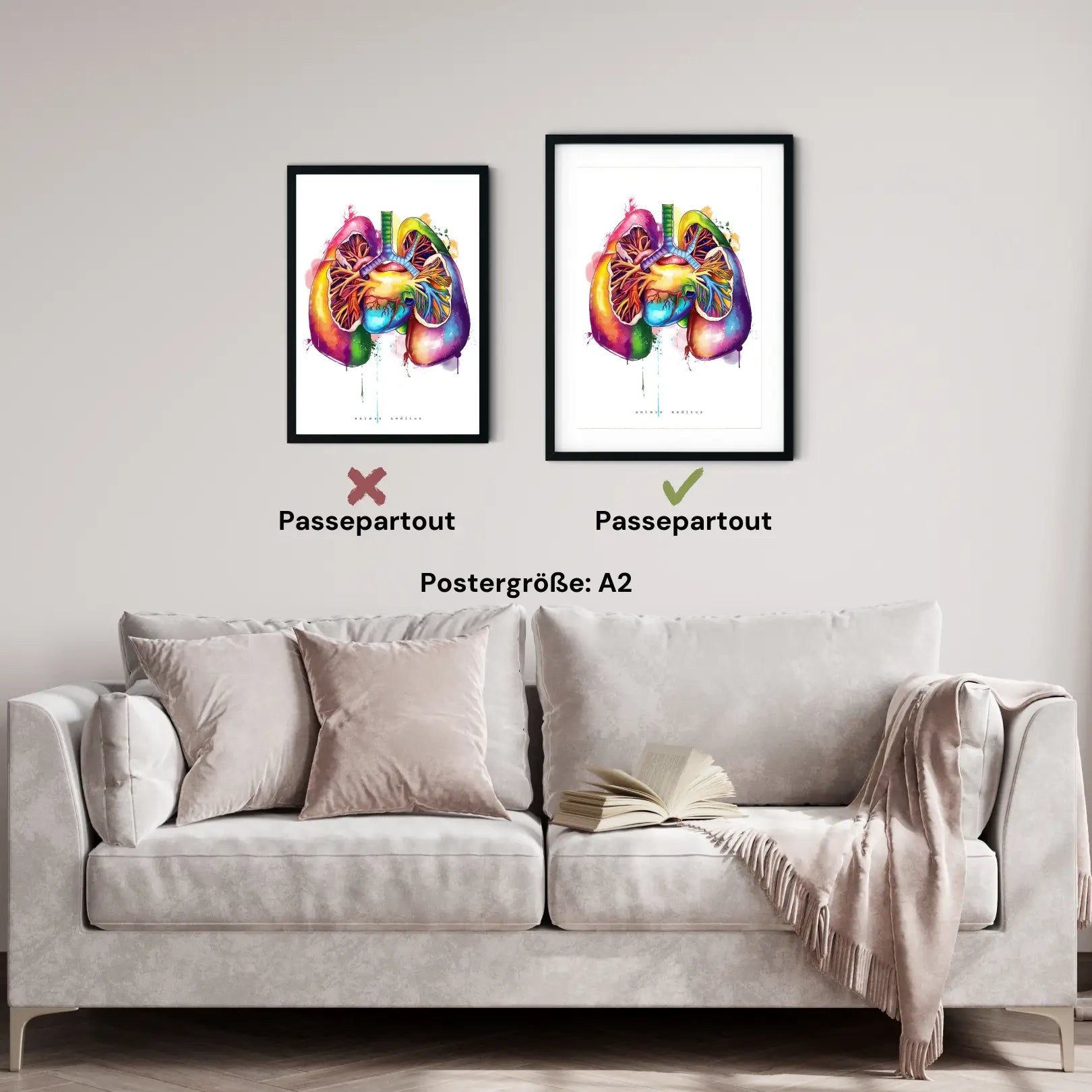 Lung Anatomy - Rainbow