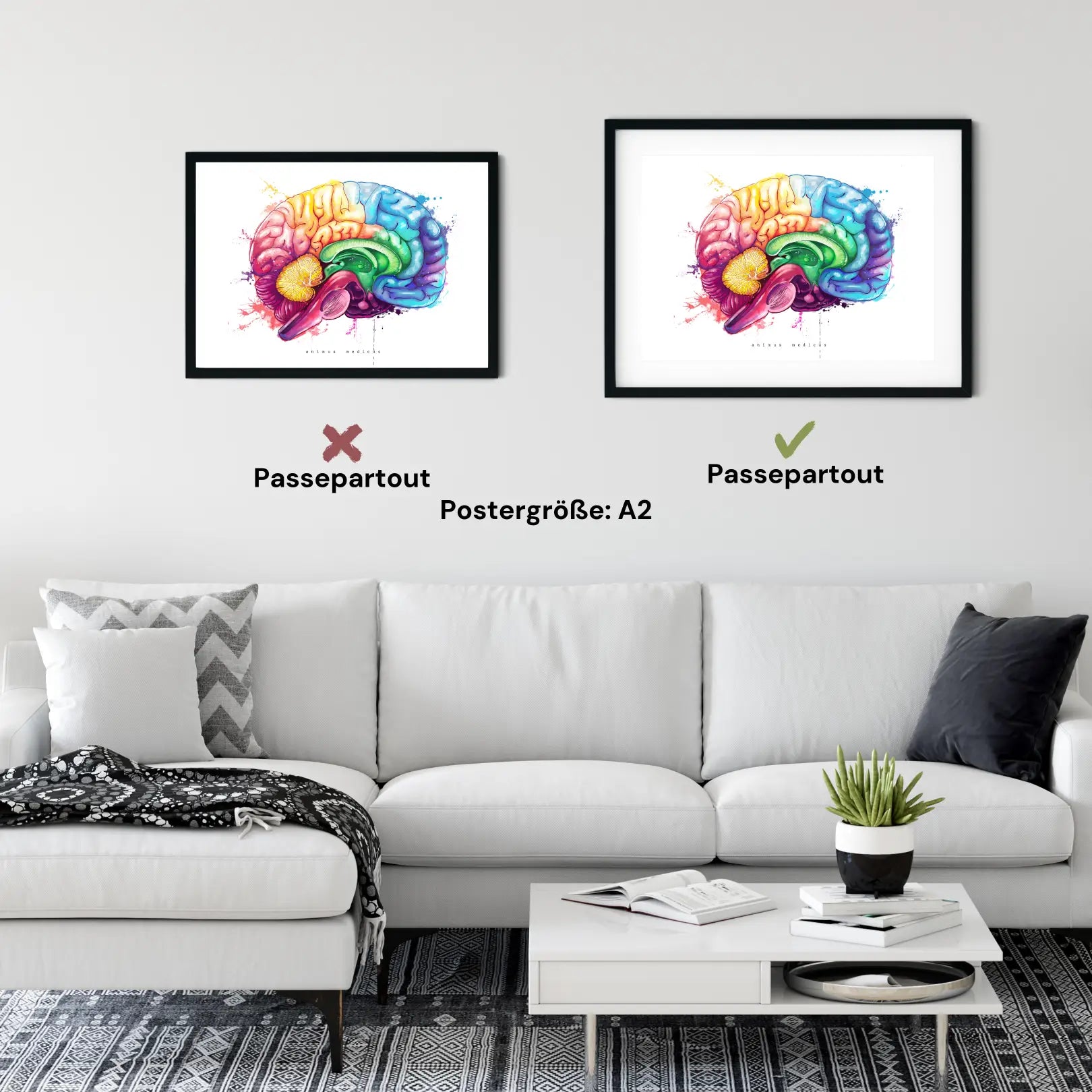 Brain Anatomy - Rainbow