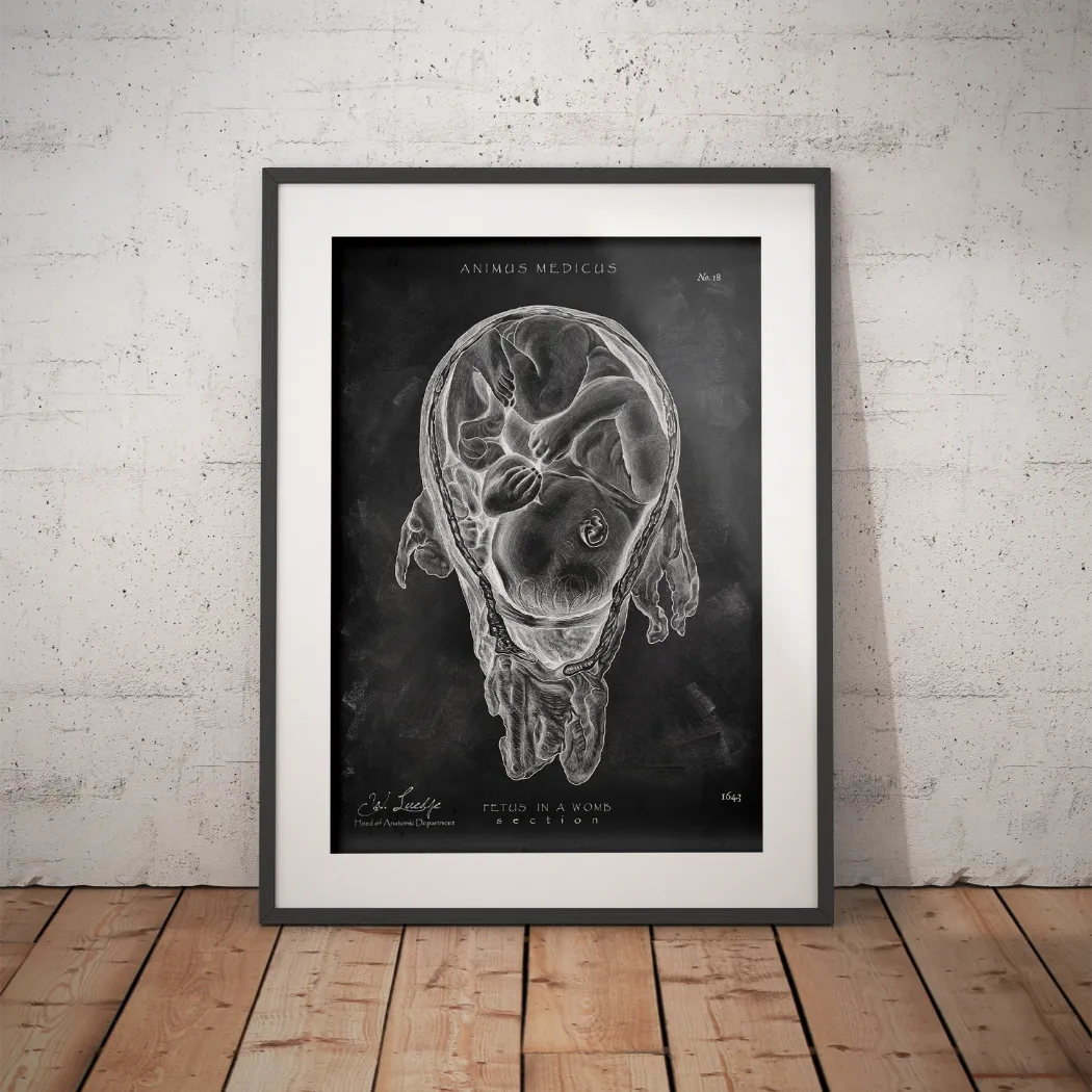 Baby in the Womb - Chalkboard