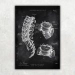 Bandscheibenvorfall Anatomie - Chalkboard - Animus Medicus GmbH