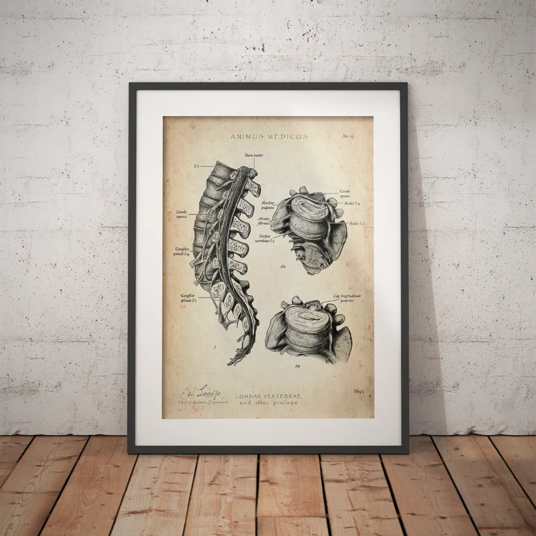 Herniated Disc Anatomy