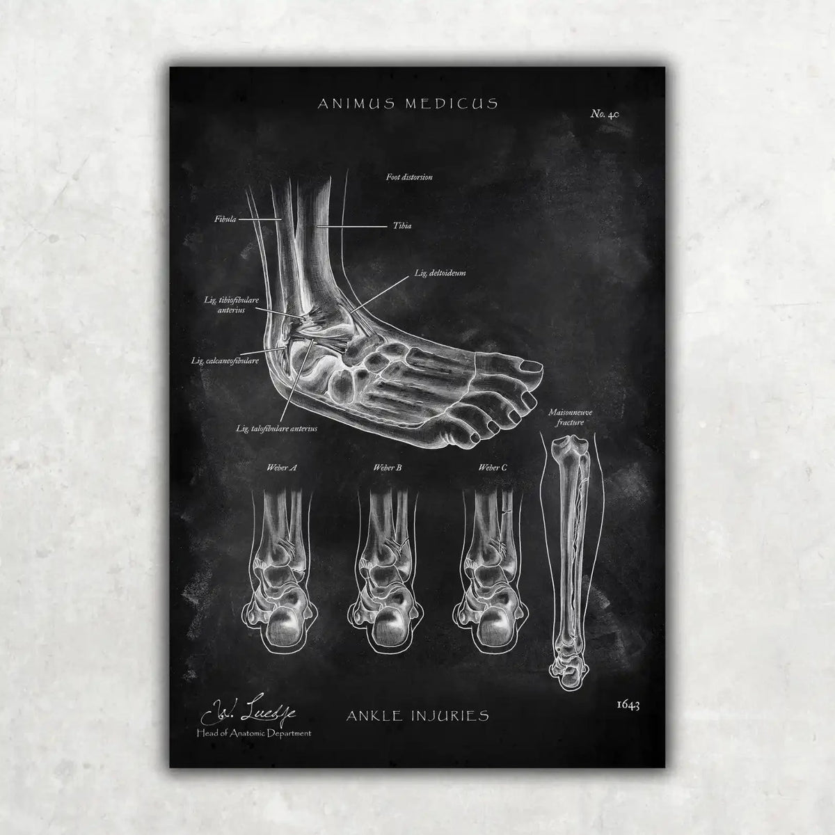 Fuß Anatomie Sammlung - Chalkboard - Animus Medicus GmbH