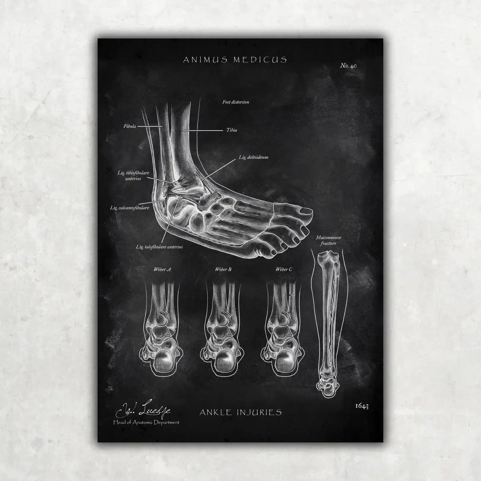 Fuß Anatomie Sammlung - Chalkboard - Animus Medicus GmbH