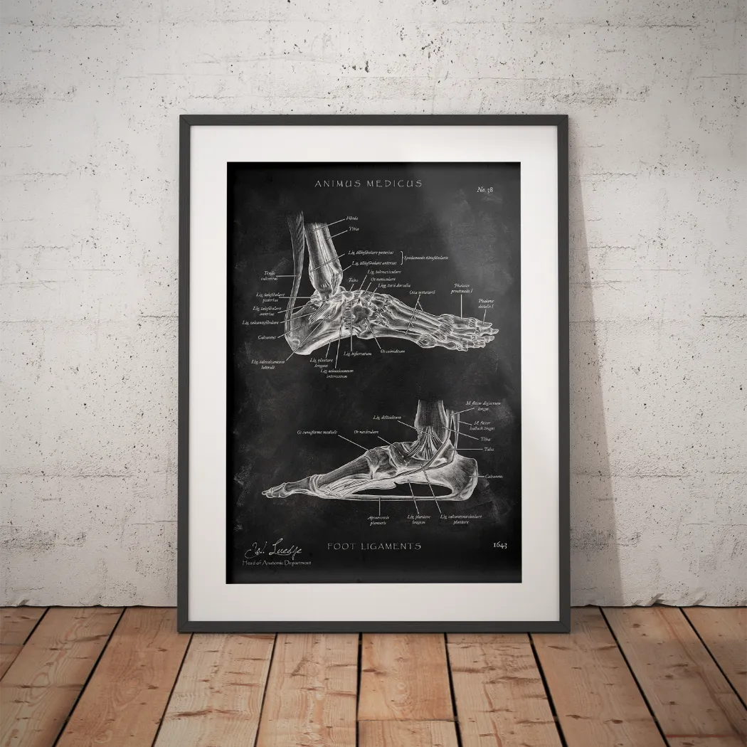 Foot straps - Chalkboard