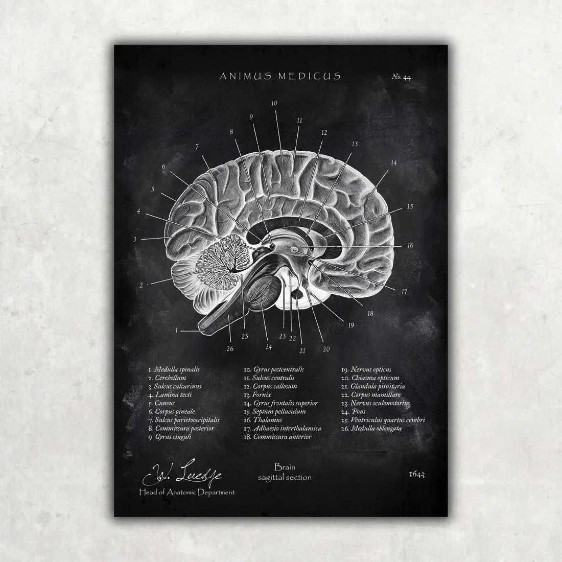 Brain Poster – Our thinking apparatus as a poster – Animus Medicus GmbH