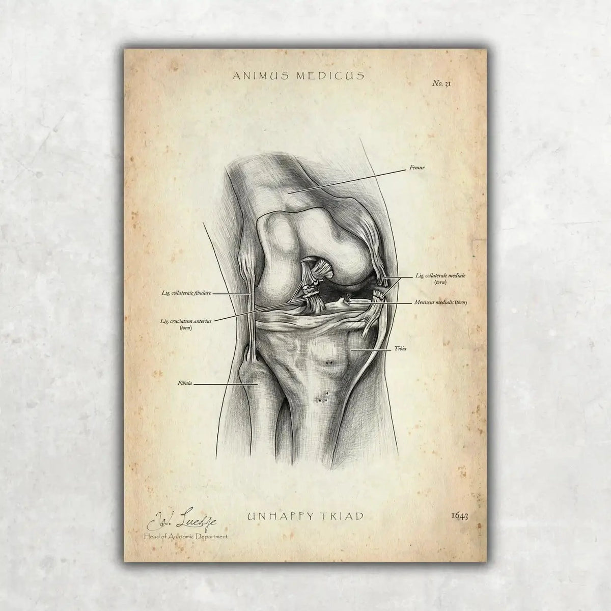 Knie Anatomie Sammlung - Animus Medicus GmbH