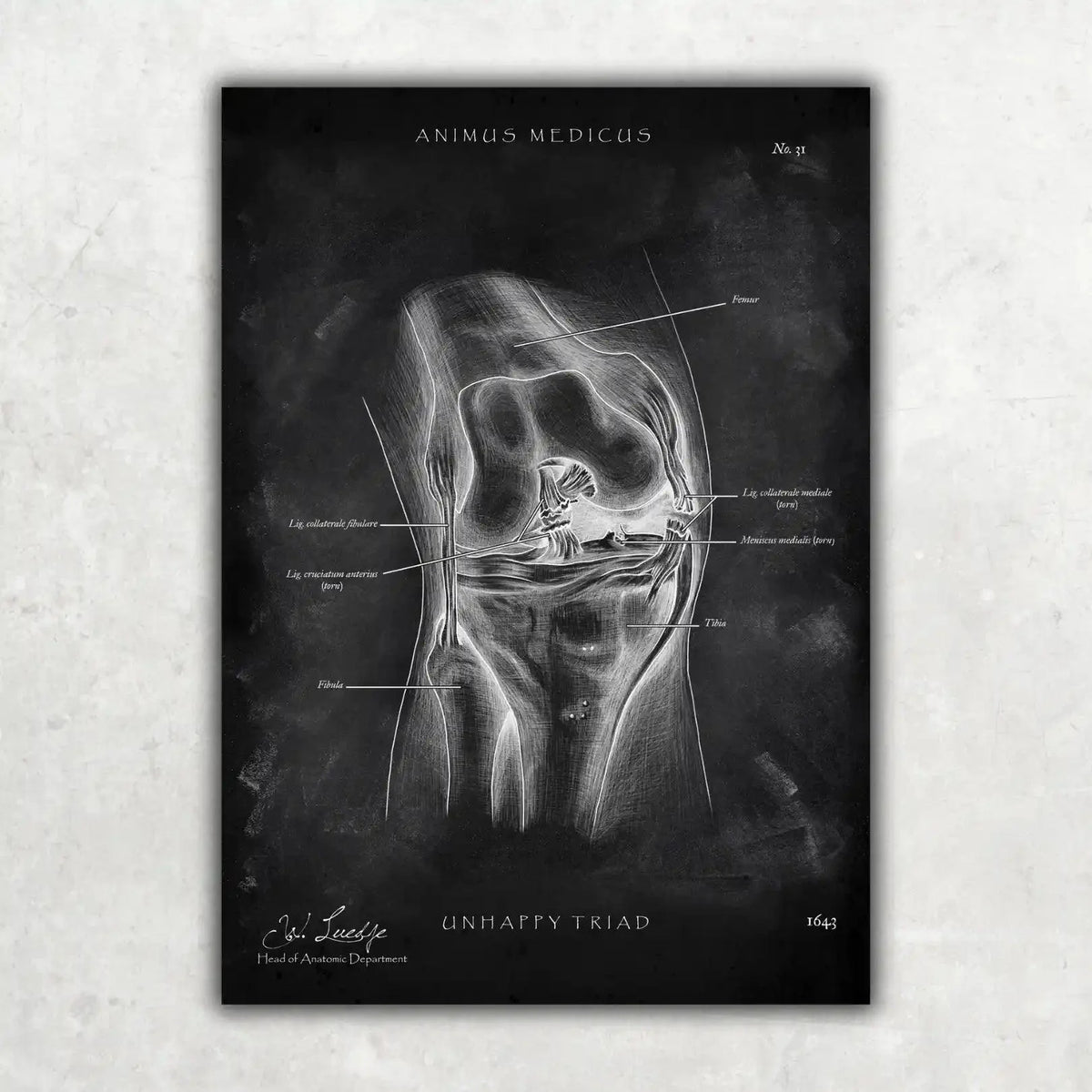 Knie Anatomie Sammlung - Chalkboard - Animus Medicus GmbH