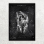 Knie Anatomie Sammlung - Chalkboard - Animus Medicus GmbH