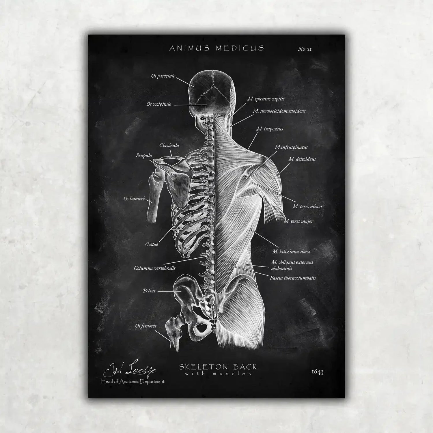 Back Anatomy Collection - Chalkboard