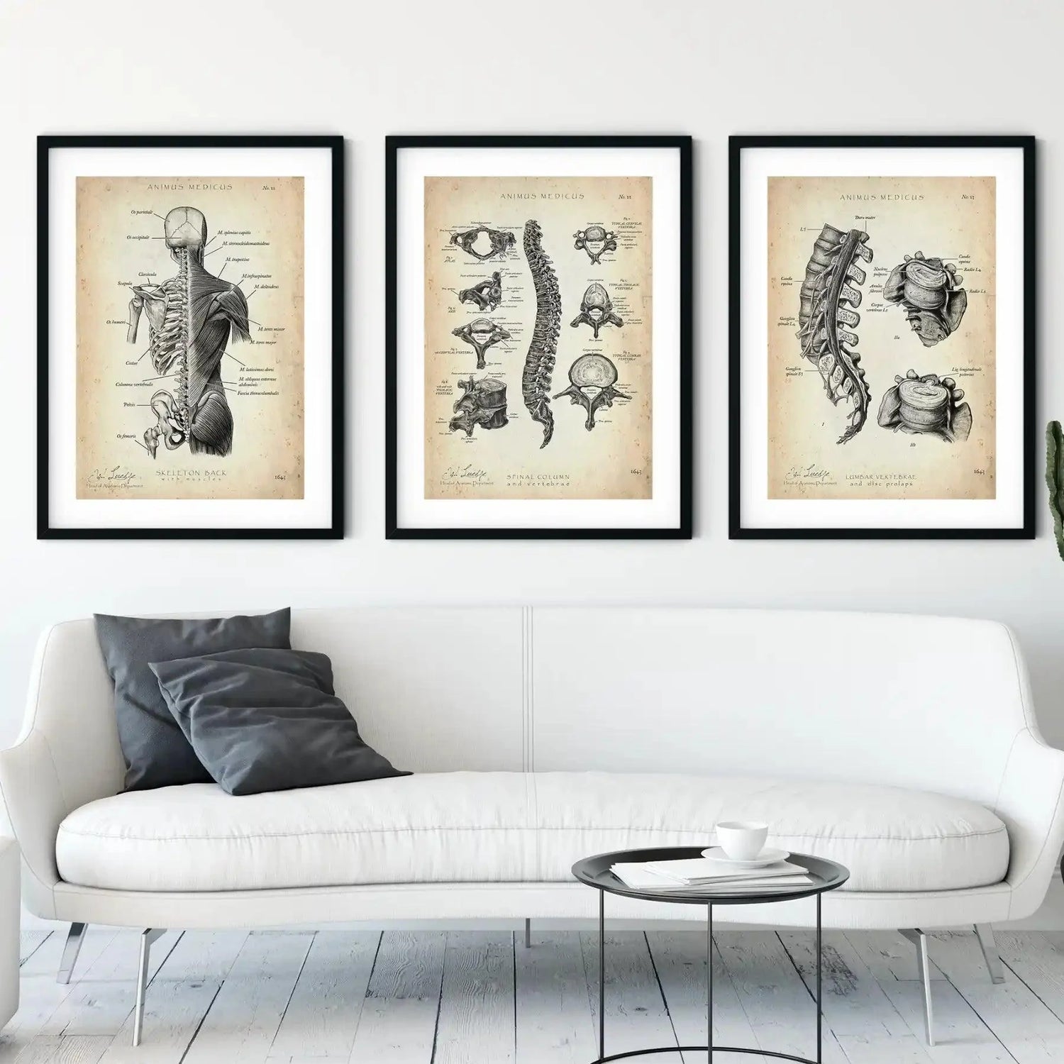 Rücken Anatomie Sammlung - Animus Medicus GmbH