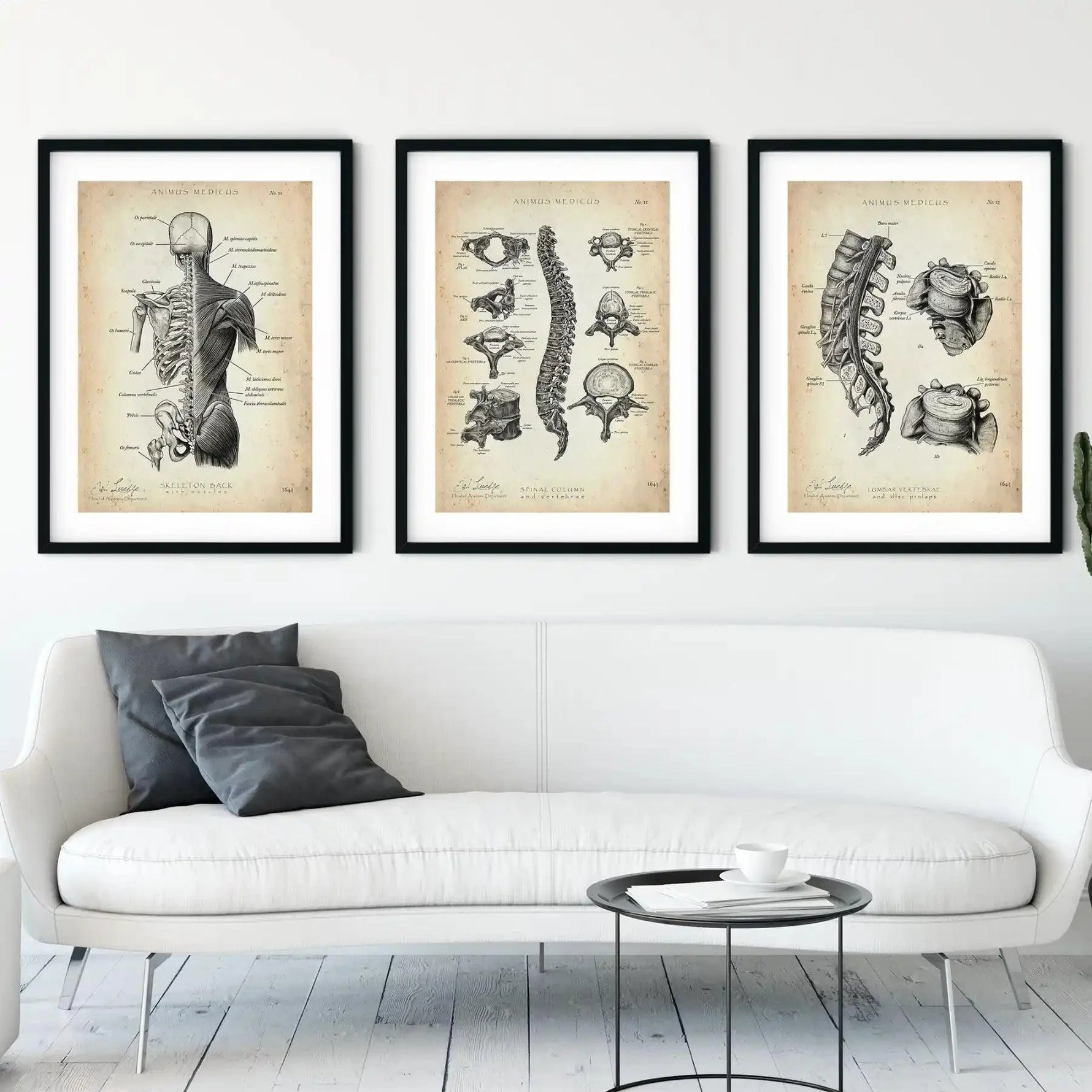 Rücken Anatomie Sammlung - Animus Medicus GmbH