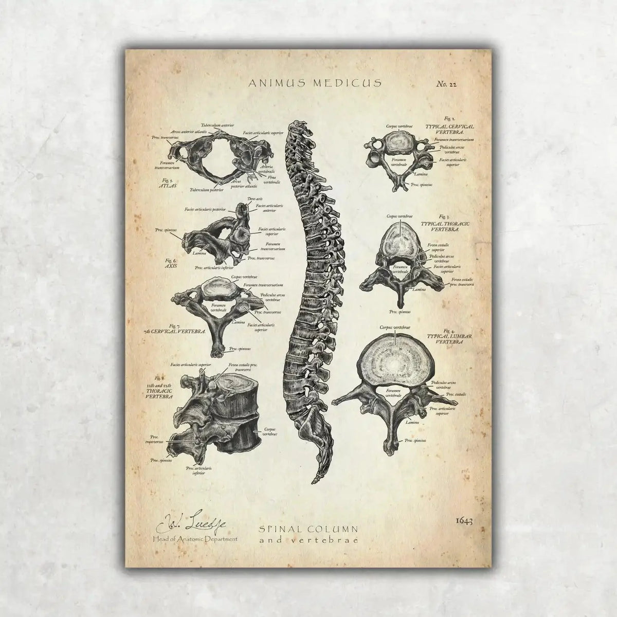 Rücken Anatomie Sammlung - Animus Medicus GmbH