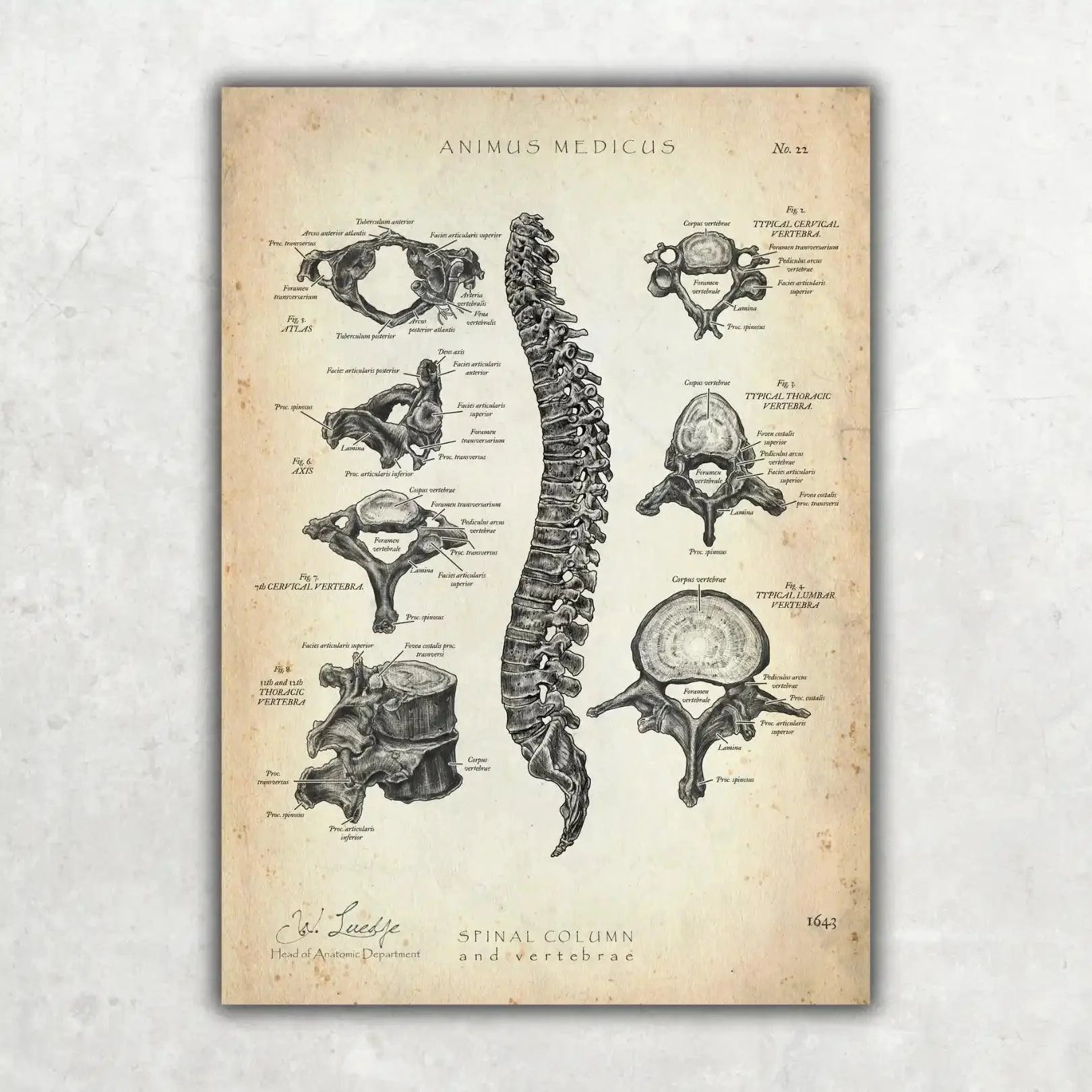 Rücken Anatomie Sammlung - Animus Medicus GmbH