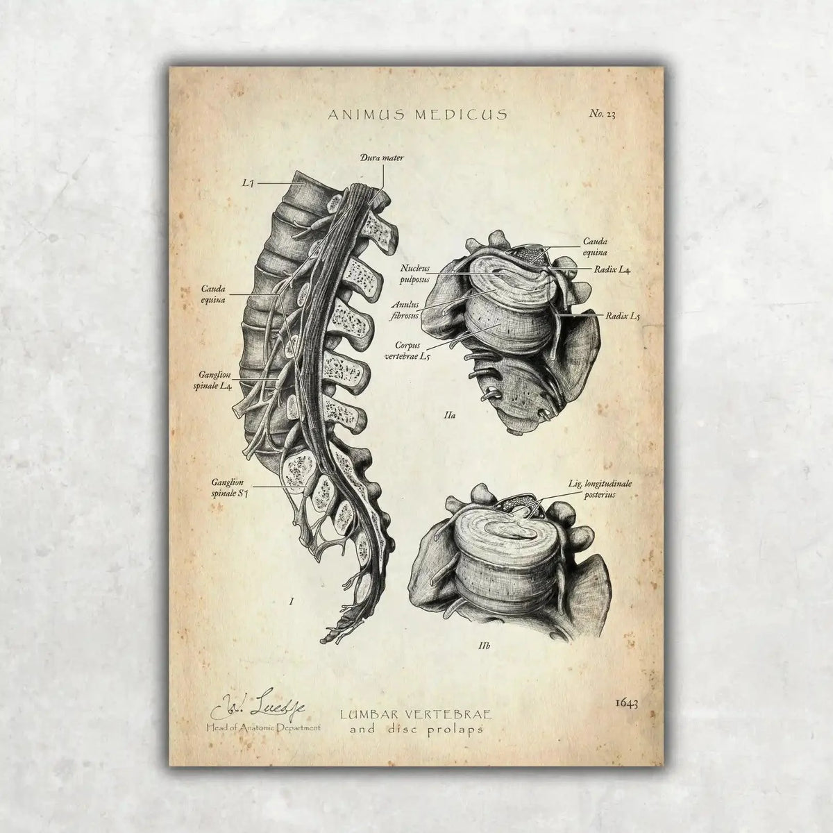 Rücken Anatomie Sammlung - Animus Medicus GmbH
