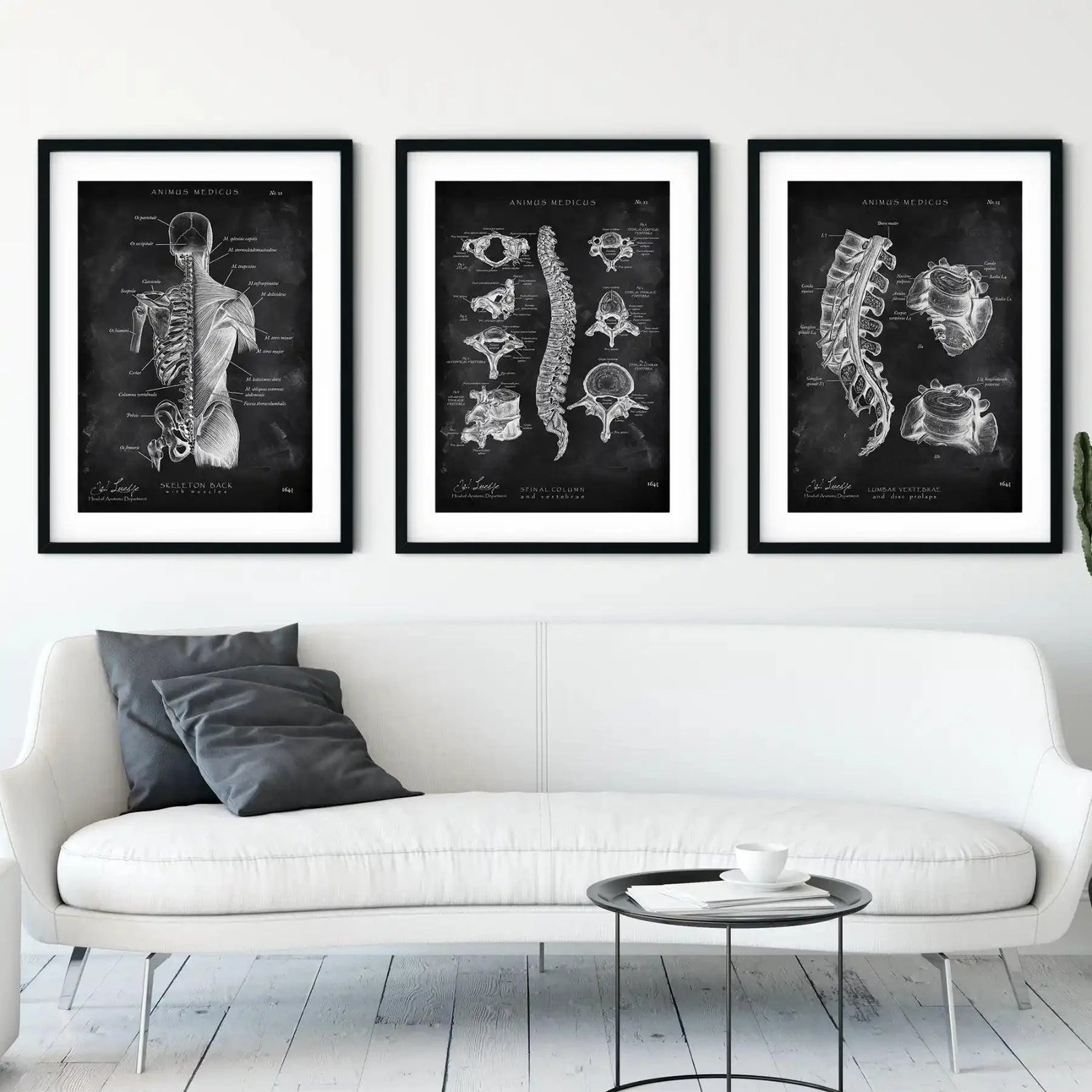 Rücken Anatomie Sammlung - Chalkboard - Animus Medicus GmbH