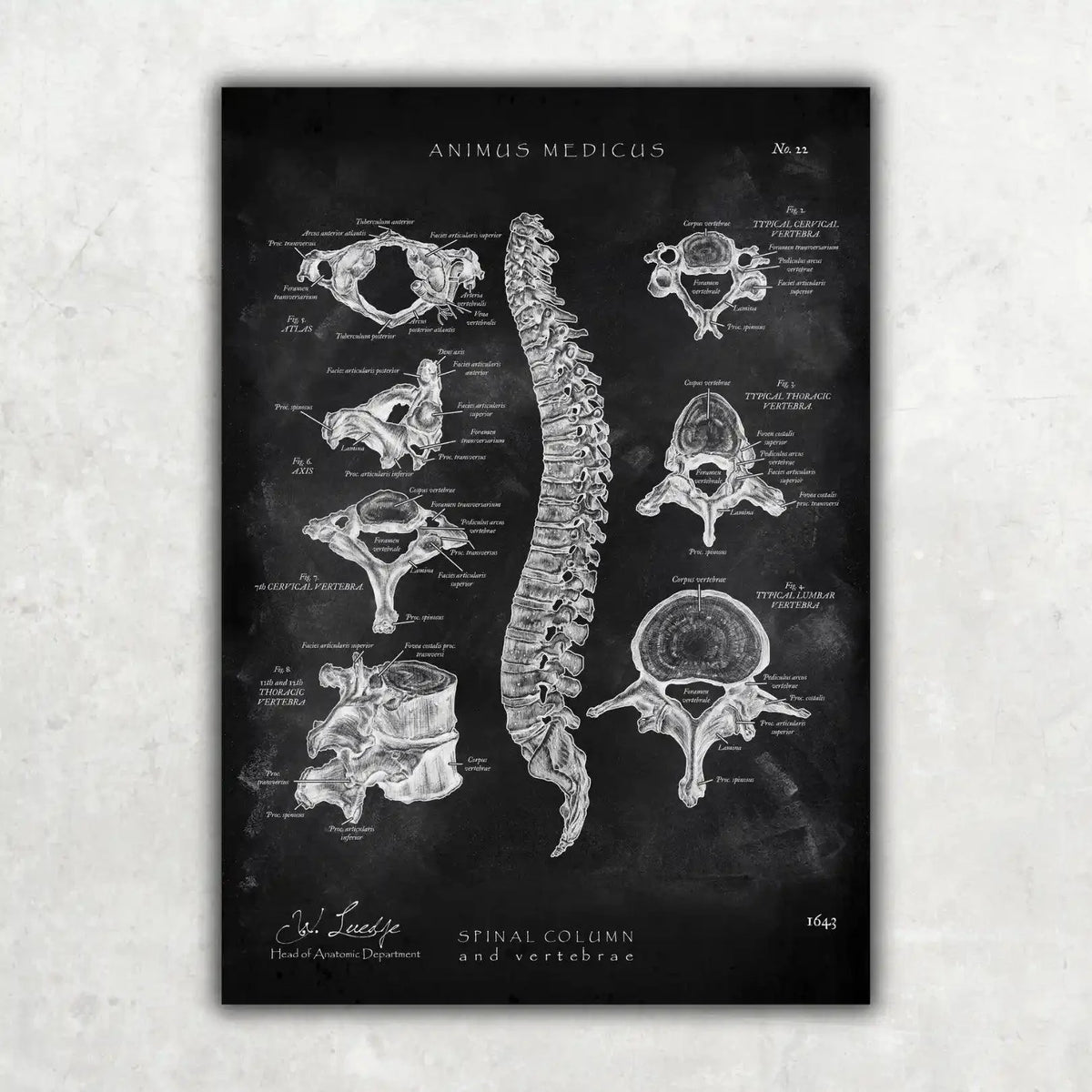 Rücken Anatomie Sammlung - Chalkboard - Animus Medicus GmbH