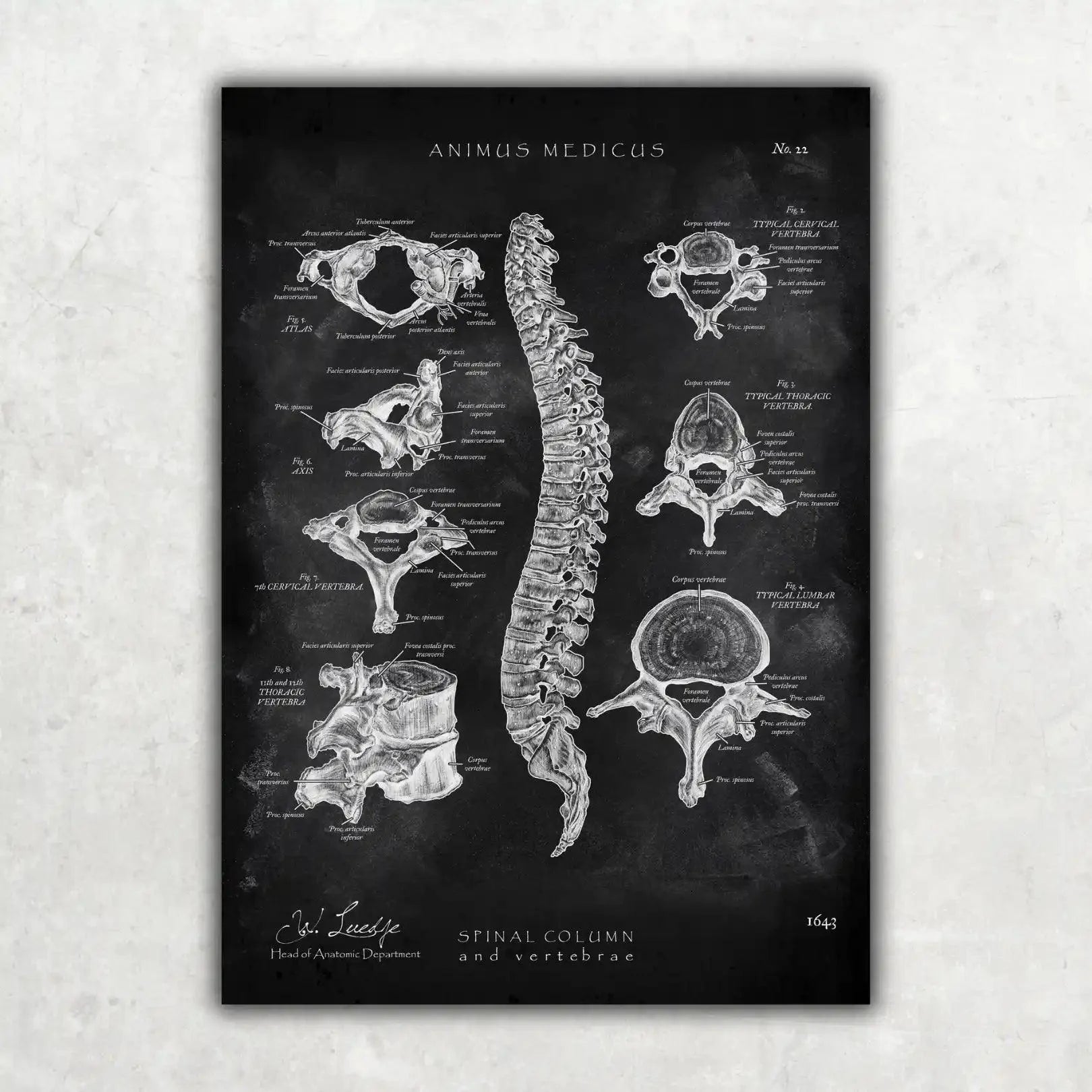 Rücken Anatomie Sammlung - Chalkboard - Animus Medicus GmbH