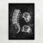 Rücken Anatomie Sammlung - Chalkboard - Animus Medicus GmbH