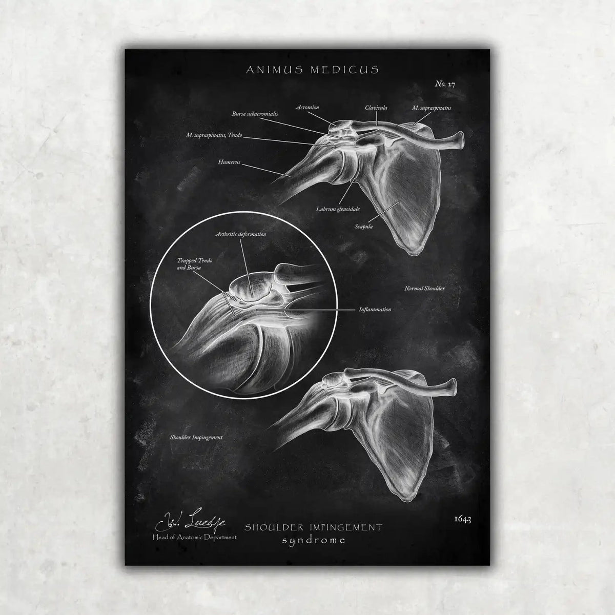 Schulter Anatomie Sammlung - Chalkboard - Animus Medicus GmbH