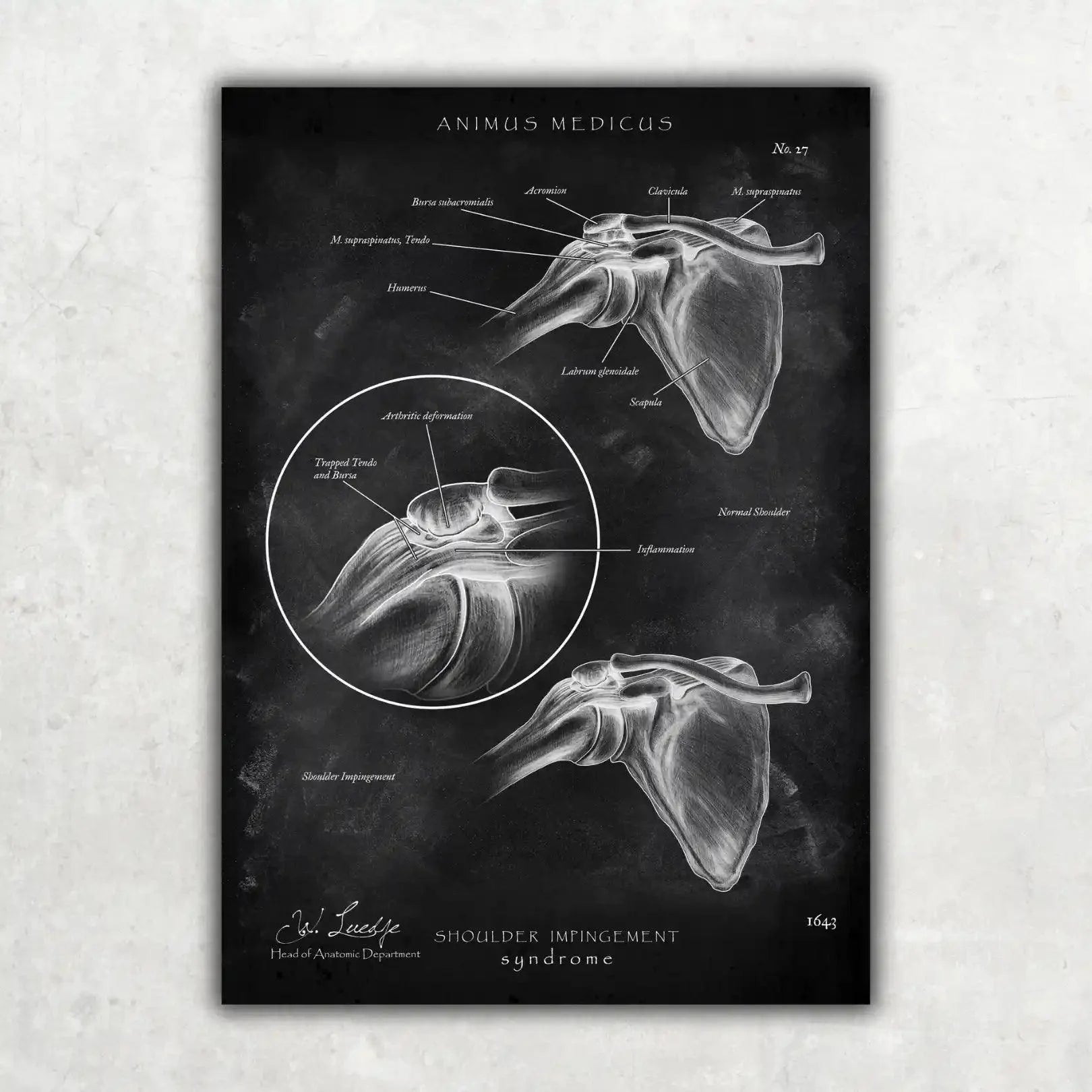 Schulter Anatomie Sammlung - Chalkboard - Animus Medicus GmbH