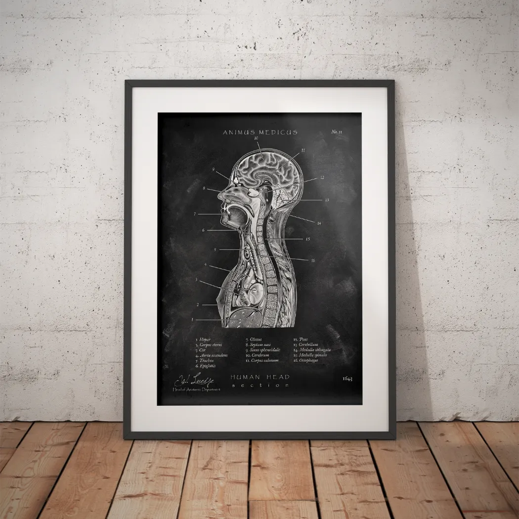 Thoracic Anatomy - Chalkboard