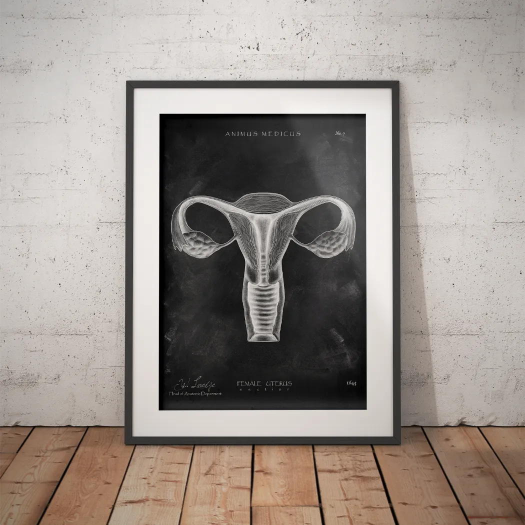 Uterus Anatomy - Chalkboard