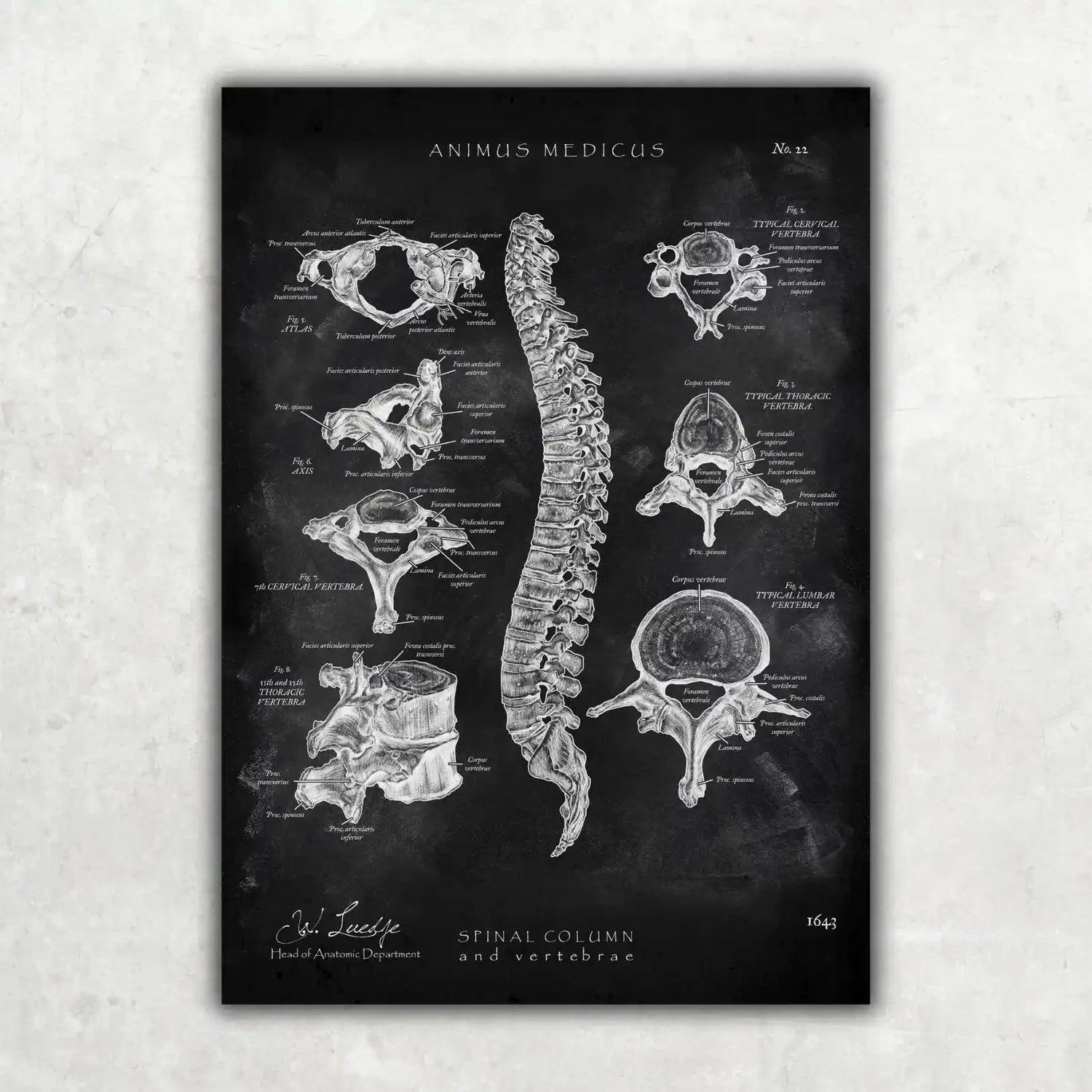 Wirbelkörper Anatomie - Chalkboard - Animus Medicus GmbH